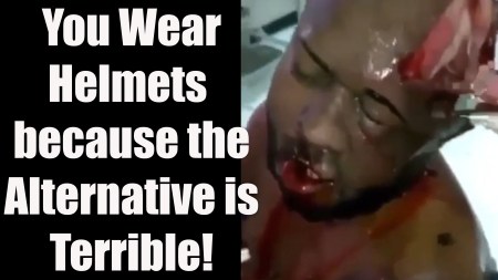 What happens when you don't wear a helmet can be devastating if you are injured during a wreck.